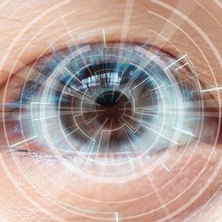 SLO LASIK & Cataract - LASIK