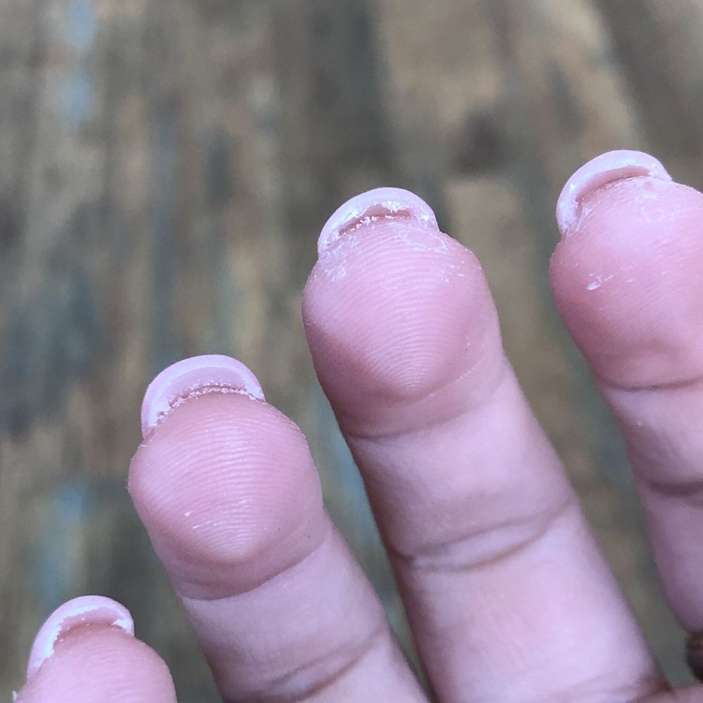 Pro Nails - Excess glue left underneath my nails - Nail Salons Near Me - Traverse City, Michigan Pro Nails - Excess glue left underneath my nails - Nail Salons Near Me - Traverse City, Michigan