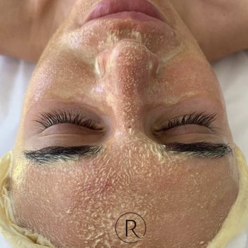 Derma Point - Oxygen infusion facial - Sugaring Near Me - Miami, Florida