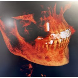 Trooper Dental Associates - 3-D scan for your jaws