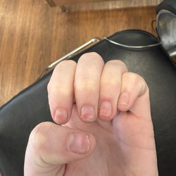 Nails By Triana - Before of left hand before I started seeing her - Nail Technicians Near Me