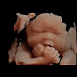 Precious Memories 3D/4D/HD Ultrasound Imaging