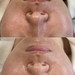 Lashes Moment - Hydrating facial     Deep hydration and repair for a more radiant complexion.