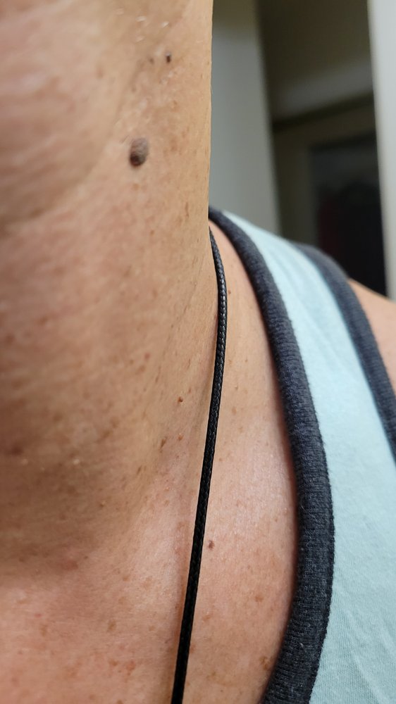 Mobile Skin Screening - home care agency in Glendale, AZ