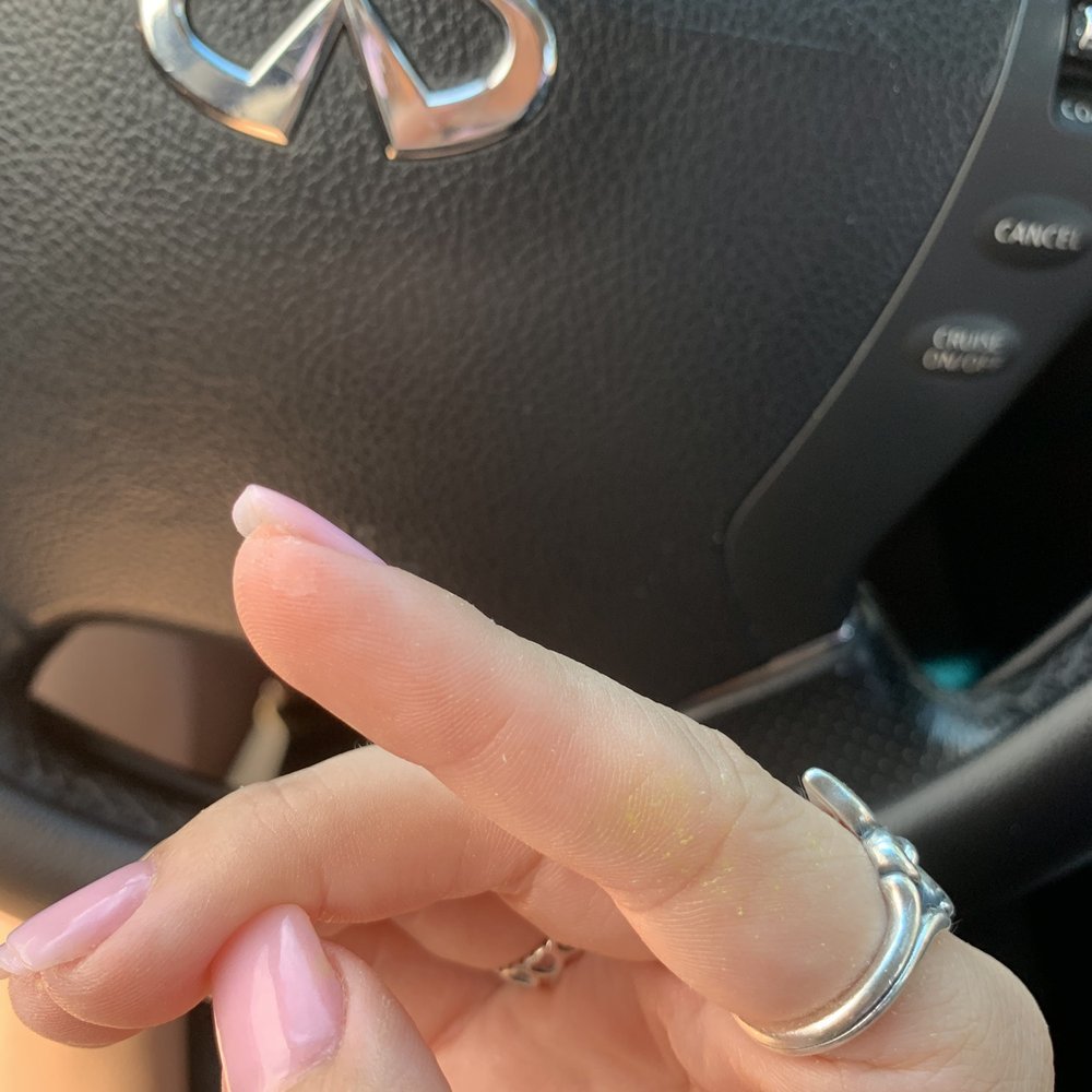 American Nail Bar - Yellow left on my finger from soaking off my dip power. - Nail Salons Near Me - Mansfield, Texas American Nail Bar - Yellow left on my finger from soaking off my dip power. - Nail Salons Near Me - Mansfield, Texas