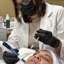 Enova MedSpa - Microneedling