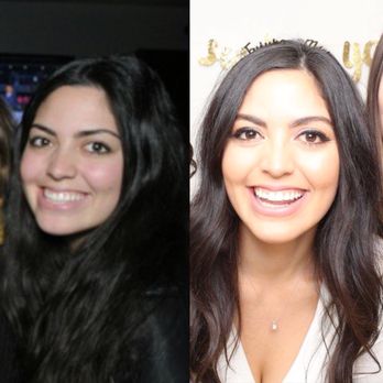 Brows - Eyebrows before to after 3 boot camp sessions - Waxing Near Me - Studio City, California