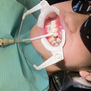 Dorminey Orthodontics - Braces time...again! - Orthodontists Near Me - Elk Grove, California