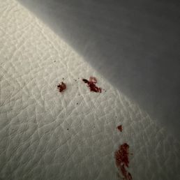 Bed bug Bed bug