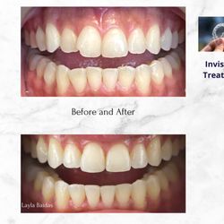 Comfort Keepers of Park Ridge - Invisalign Dentist