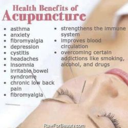 Juno Wellness Acupuncture