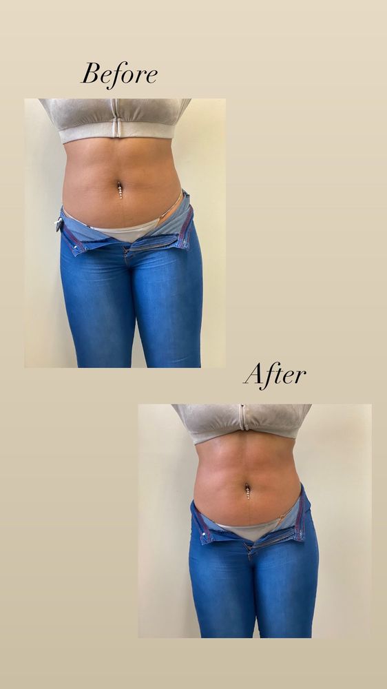 IT’S A LIFESTYLE BODY SCULPTING & FITNESS 17 Photos 10520 Baltimore