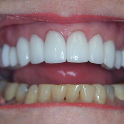 Harris Parkway Dental Care