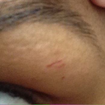 Perfect Brows NYC - Tiny cuts on brow post threading. She didn't even apologize. - Waxing Near Me - New York, New York Perfect Brows NYC - Tiny cuts on brow post threading. She didn't even apologize. - Waxing Near Me - New York, New York