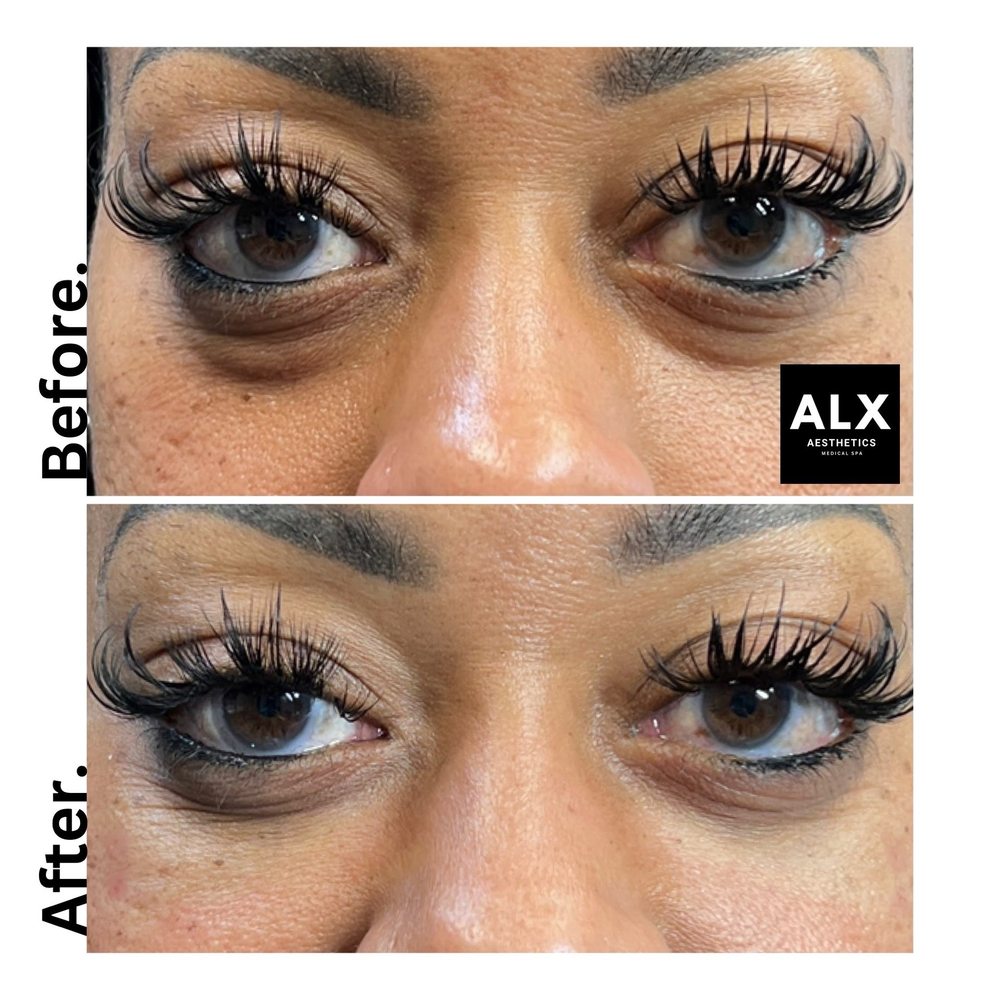 ALX Aesthetics Logo