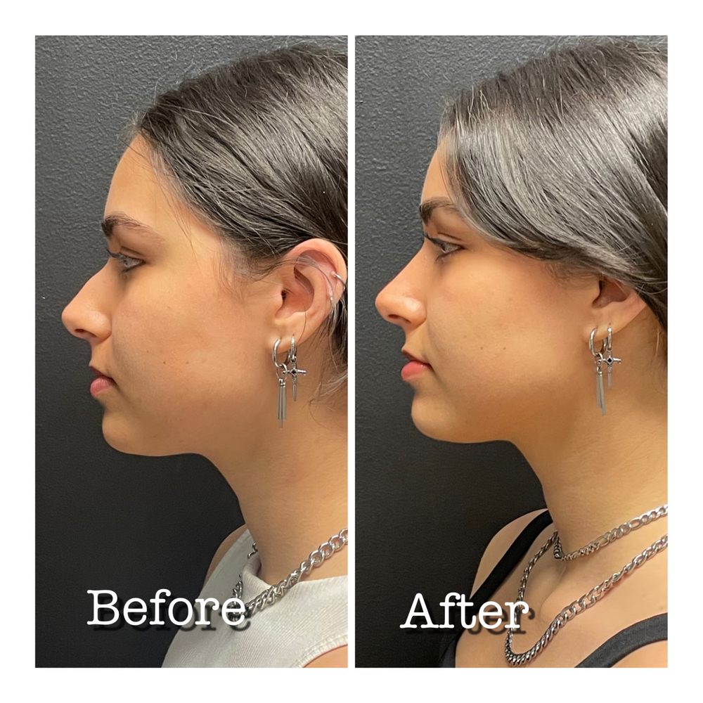 Edmund Fisher, MD, FACS Logo