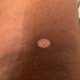 This 4 weeks after my last appointment. This 4 weeks after my last appointment.