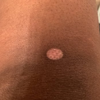 Phaze Laser Med Spa - This 4 weeks after my last appointment. - Medical Spas Near Me - Las Vegas, Nevada Phaze Laser Med Spa - This 4 weeks after my last appointment. - Medical Spas Near Me - Las Vegas, Nevada