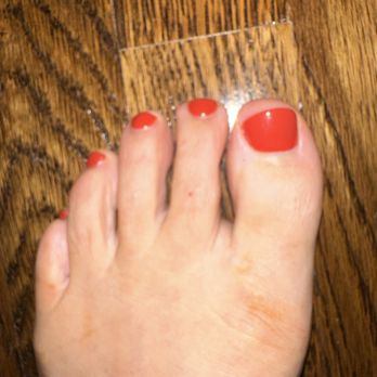 Omega Nail Boutique - Crooked toe nail cut. - Nail Salons Near Me - Birmingham, Alabama Omega Nail Boutique - Crooked toe nail cut. - Nail Salons Near Me - Birmingham, Alabama