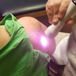 Sands Point Physical Therapy - The LiteForce EX Deep Tissue Laser in action