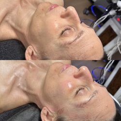 The Velvet Beauty Room - Deluxe HydraFacial $250