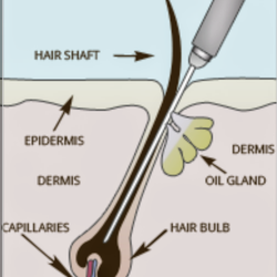 Electrolysis demo