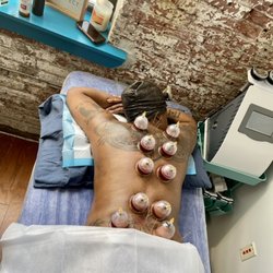 Hijama Cupping Therapy - Mental Clarity & Stress Relaxation practice. Full Detox through Cupping
