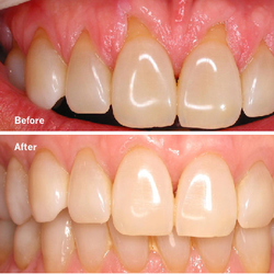 Thousand Oaks Dental