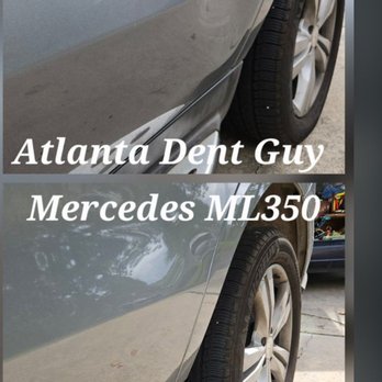 Atlanta Dent Guy - "Another One" by Atlanta Dent Guy - Mobile Dent Repair Near Me Atlanta Dent Guy - "Another One" by Atlanta Dent Guy - Mobile Dent Repair Near Me