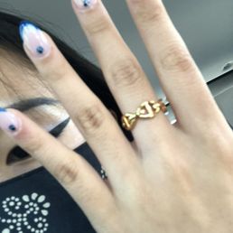 my nails with some redness/swelling around the cuticles