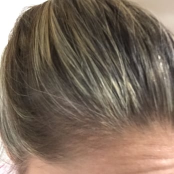 Allure Med Spa and Salon - Bleed mark from partial foils. Didnt notice it at first but had to re-part my hair to hide it last couple of months.. - Day Spas Near Me - Quincy, Massachusetts Allure Med Spa and Salon - Bleed mark from partial foils. Didnt notice it at first but had to re-part my hair to hide it last couple of months.. - Day Spas Near Me - Quincy, Massachusetts