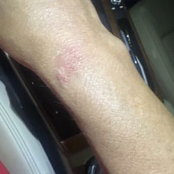 Ochsner Urgent Care