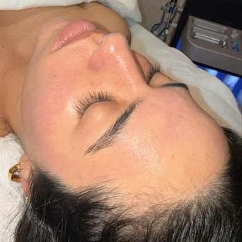 Epanouir Aesthetic & Longevity Center - Hydra facial - Skin Care Near Me - Carlsbad, California Epanouir Aesthetic & Longevity Center - Hydra facial - Skin Care Near Me - Carlsbad, California