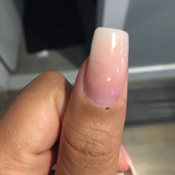 Barry's Beauty Bar - Look towards the middle left (hairline crack and nail is starting to break) and look at my scab (thumb also started bleeding) - Hair Salons Near Me - Brooklyn, New York