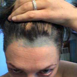 I asked her to wipe the dye off my forehead. Also, my skin is blue and my hair is still brown. I asked her to wipe the dye off my forehead. Also, my skin is blue and my hair is still brown.