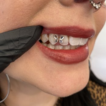 Diente Dulce Tooth Bling - Butterfly Gem - Teeth Whitening Near Me - Oakland, California