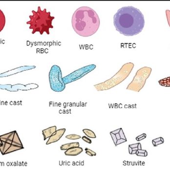 Highland Pet Hospital - Stuff you'll see in urine, including casts and crystals. - Veterinarians Near Me - Bloomington, Illinois