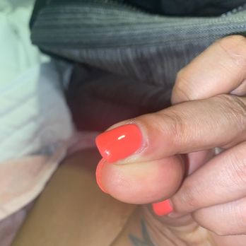 LUX NOA Nail Spa - Swollen and sore cuticle. - Day Spas Near Me - Cypress, Texas