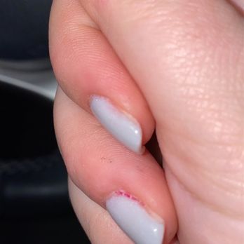 ProTop Nails - My old nail polish peaking through - Nail Salons Near Me - Roseville, California