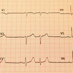Blue Coast Cardiology