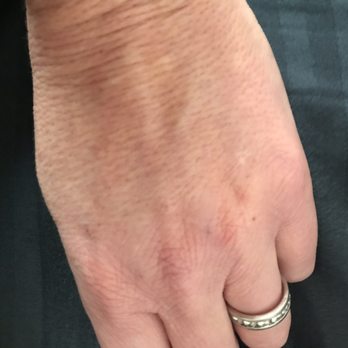 KP Aesthetics - Skin Care Near Me - Newtown Square, Pennsylvania KP Aesthetics - Skin Care Near Me - Newtown Square, Pennsylvania