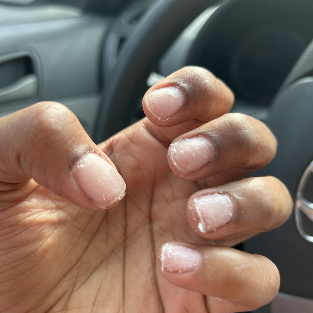 This is NOT normal removal. This is damage from incompetence, period This is NOT normal removal. This is damage from incompetence, period