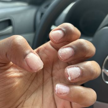 Square Nails - Austin - This is NOT normal removal. This is damage from incompetence, period - Nail Salons Near Me - Austin, Texas