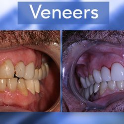 Carolina Forest Cosmetic Dentistry