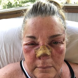 Skin Cancer & Cosmetic Dermatology Center - Here's Day 2...