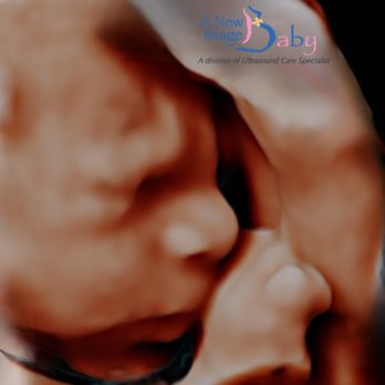A New Image Baby - HD(5D) Baby Ultrasound
32 Weeks - Diagnostic Imaging Near Me - Orlando, Florida A New Image Baby - HD(5D) Baby Ultrasound
32 Weeks - Diagnostic Imaging Near Me - Orlando, Florida