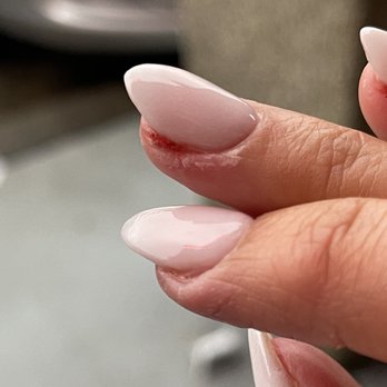 Lux Nails & Spa - Huge cut on the Edge of my finger - Nail Salons Near Me - Lilburn, Georgia