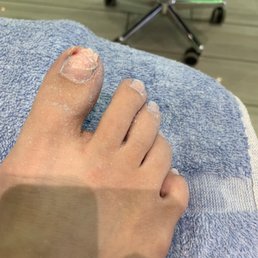 My toe 5 mins in to my appt My toe 5 mins in to my appt