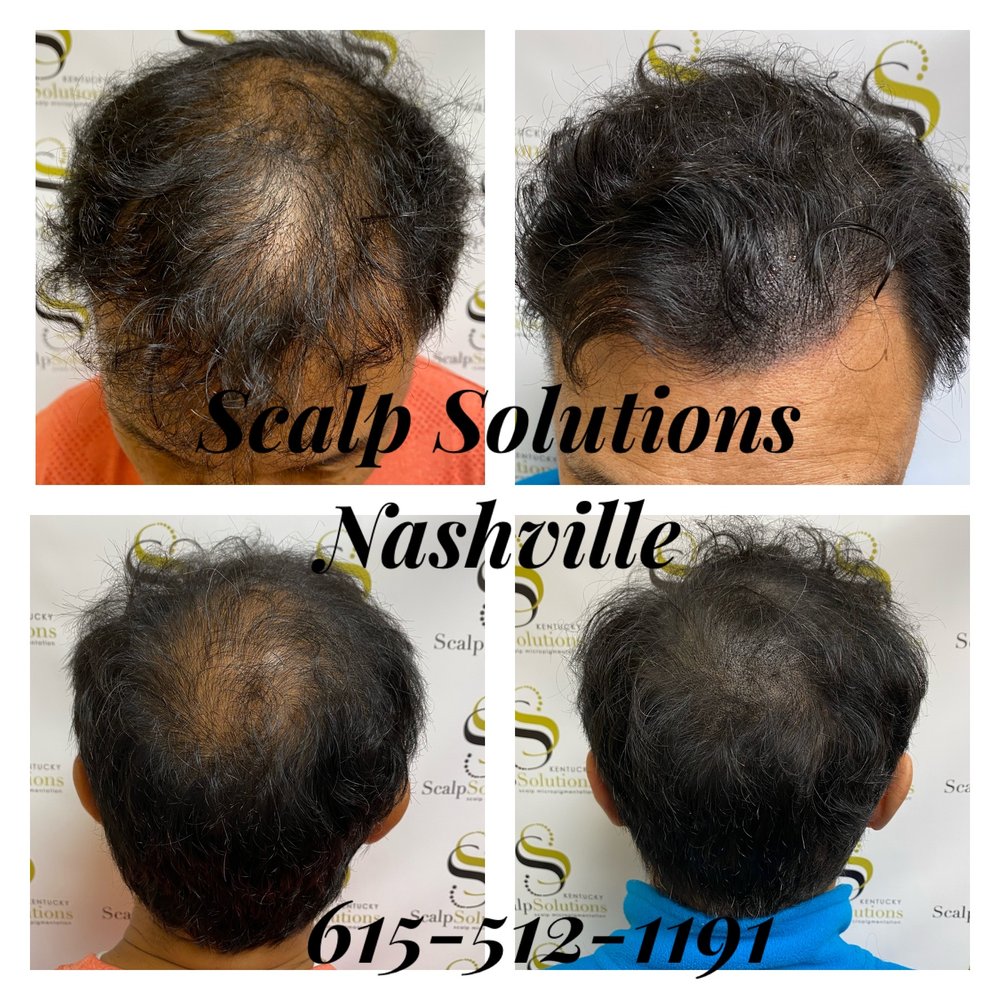 SCALP SOLUTIONS NASHVILLE Updated July 2024 51 Photos 1806