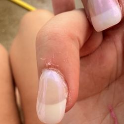 Pacific Hair & Nails - This is after 2/3 days of getting them done. There is also a yellowing under the acrylic.